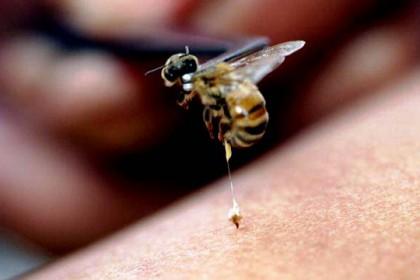 Կնճիռները հարթեցնող լավագույն միջոցը մեղվի թույնն է