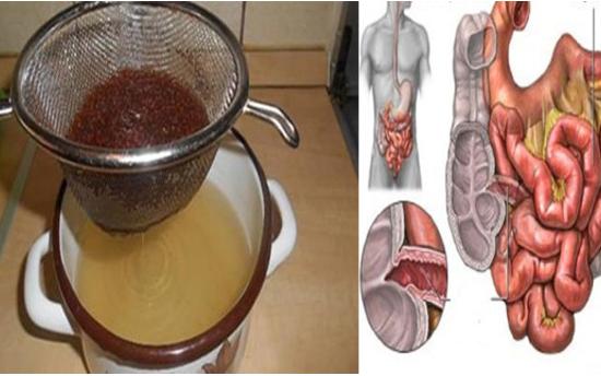 Առօրյա սննդի պատճառով օրգանիզմում թույներ, պարազիտներ են կուտակվում։ Մաքրեք այն ձեր աղիներից, ահա թե ինչպես ․․․