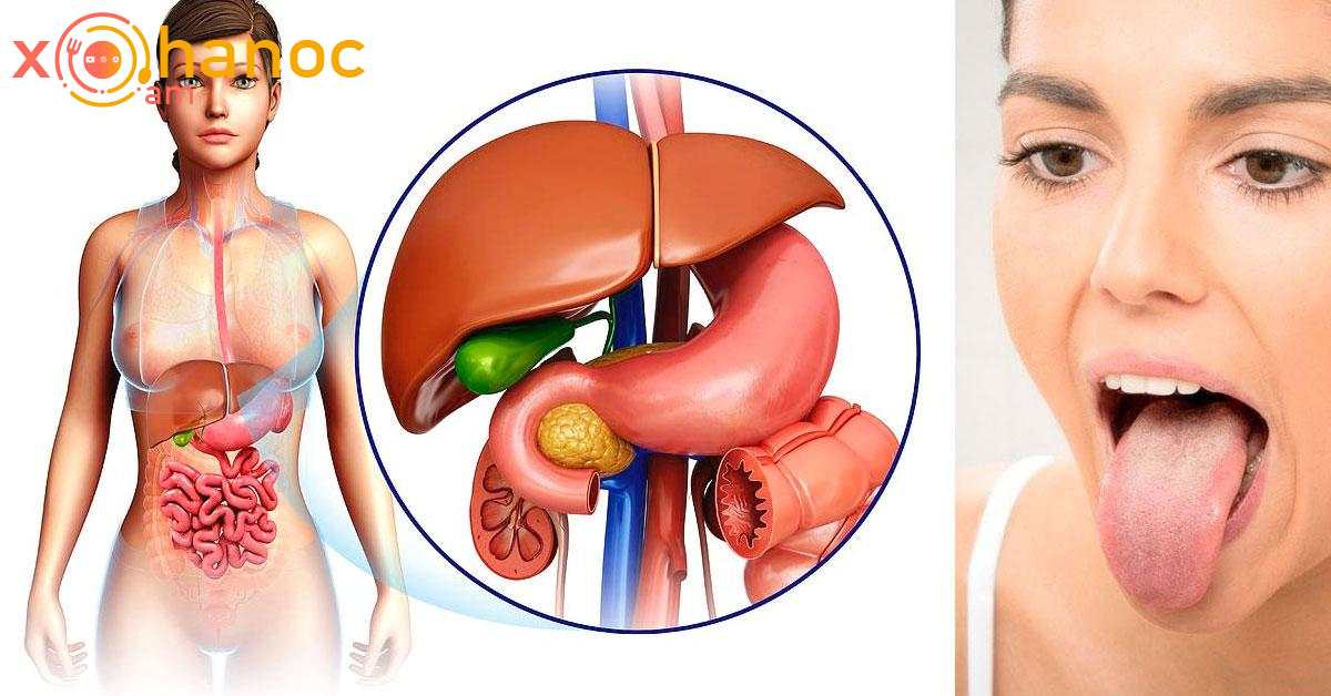 Եթե ձեր լեզվի վրա կա այս նշանը, ուրեմն լյարդի և ստամոքսի լուրջ խնդիրներ ունեք ՝ առանց ախտանիշ