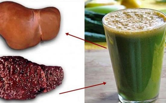 Մաքրեք լյարդը ճարպից, վերականգնեք դրա գործունեությունն ընդամենը 7 օրվա ընթացքում