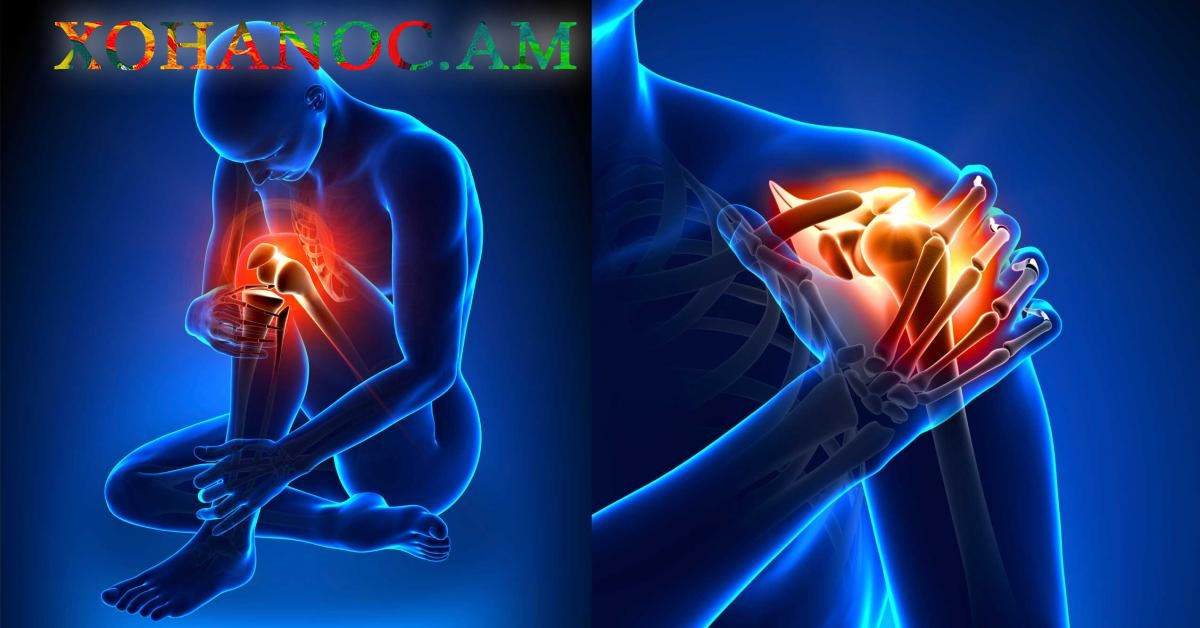 Ամրացրեք ձեր ոսկորները, վերականգնեք հոդերը այս բնական բաղադրիչի միջոցով