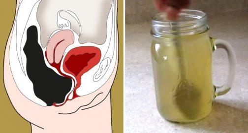 Աղիների մաքրում տնային պայմաններում 