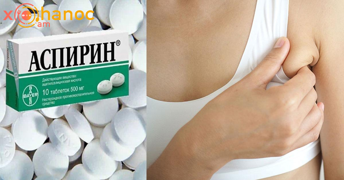 Ասպիրինով այս հնարքի մասին յուրաքանչյուր ամուսնացած կին պետք է իմանա Ասպիրինով այս հնարքի մասին յուրաքանչյուր ամուսնացած կին պետք է իմանա