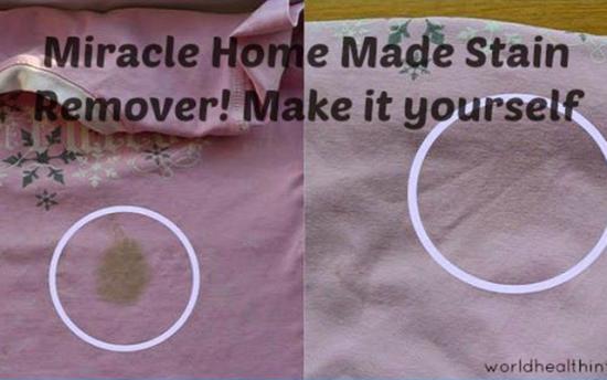 Հեռացրեք հետքերը հագուստի վրայից