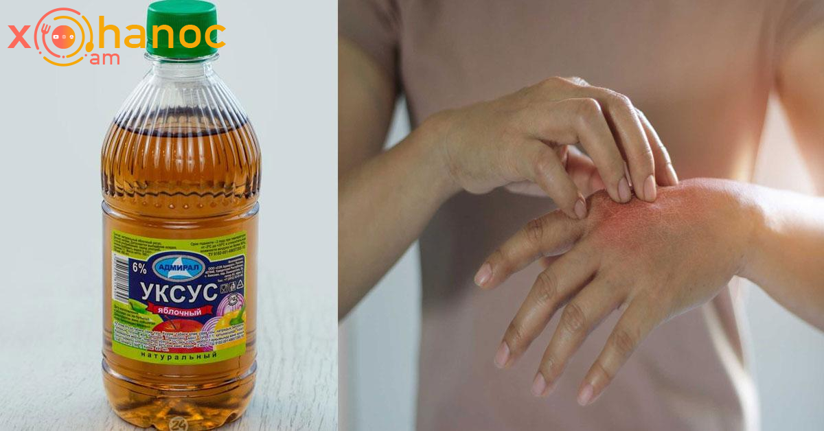 Տեսեք ինչ տհաճ խնդրից կարող եք ազատվել քացախի միջոցով․ Ափսոս շուտ չգիտեի այս մասին