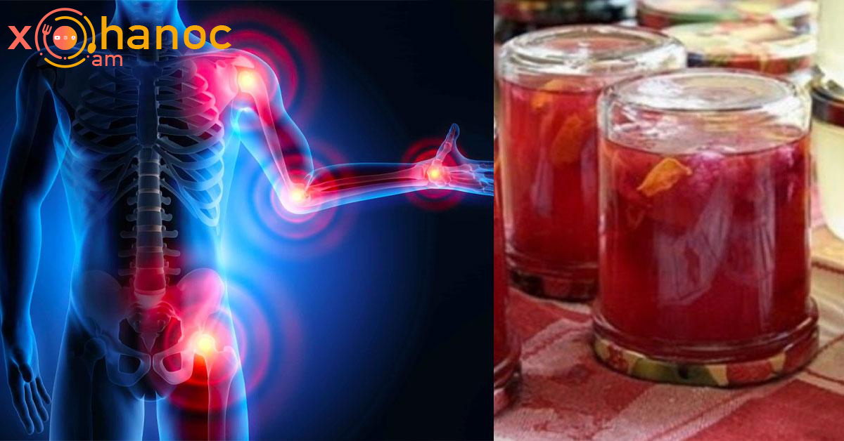 Սոված փորին ընդունեք այս բաղադրատոմս և մոռացեք հոդերի, մեջքի և ոտքերի ցավի մասին Սոված փորին ընդունեք այս բաղադրատոմս և մոռացեք հոդերի, մեջքի և ոտքերի ցավի մասին