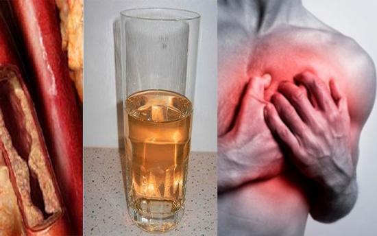 Բոլորը կցանկանային այս միջոցը շուտ իմանային․ Անոթները մաքրելու ամենահզոր միջոցը