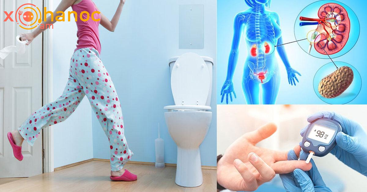 Գիշերային ժամերին զուգարան գնալ և միզելը վկայում է այս լուրջ հիվանդության մասին