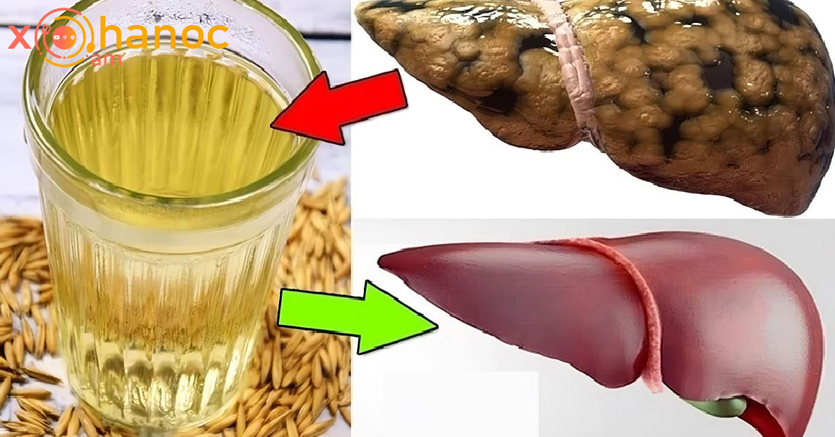 Այս միջոցը կօգնի մաքրել լյարդը ճարպից, նիհարել և բարելավել ինքնազգացողությունը