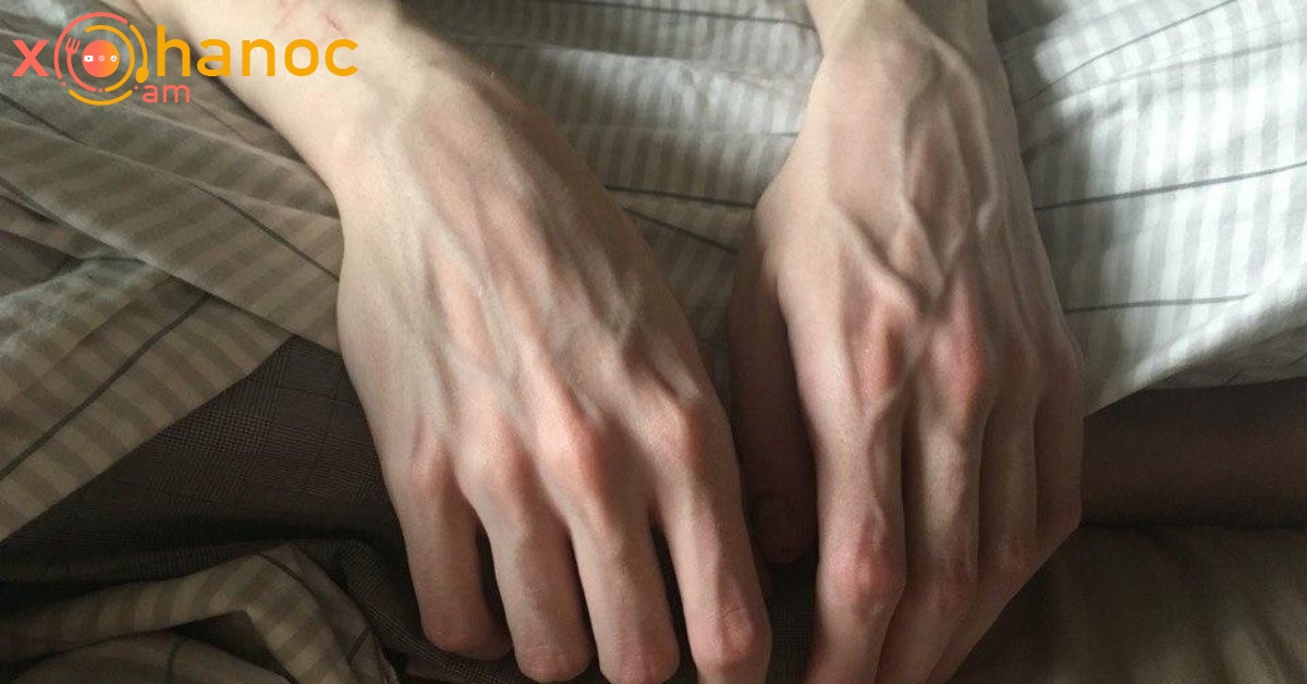 Ի՞նչ առողջական խնդիրի մասին է վկայում, եթե ձեռքերի վրա երակներ են հայտնվում