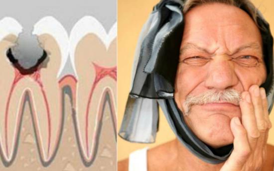 Հրաշալի միջոց ատամնացավի դեմ
