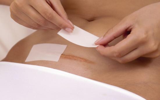 Որտեղի՞ց է առաջացել «կեսարյան հատում» տերմինը