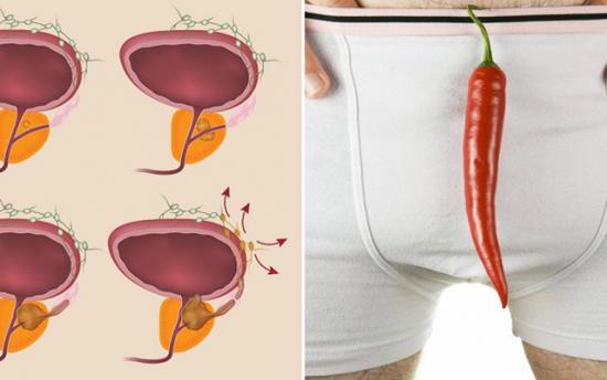 Շագանակագեղձի առողջությանը նպաստող մթերքներ