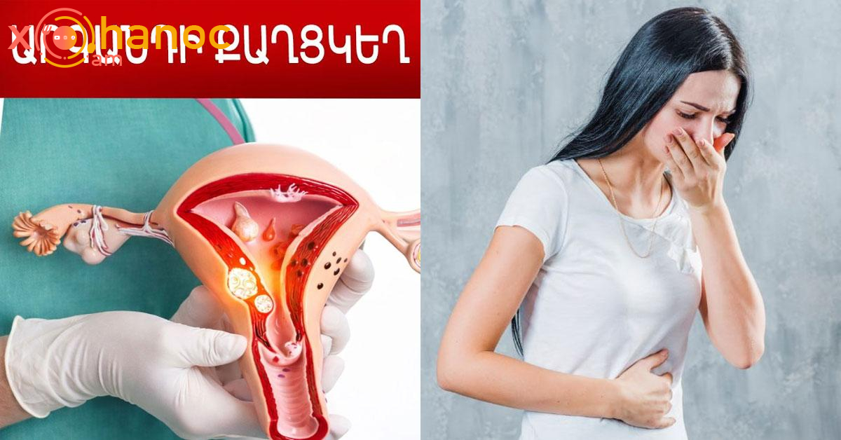 Սա արգանդի քաղցկեղի առաջին նշանն է․ Մի անտեսեք սիրելի կանայք