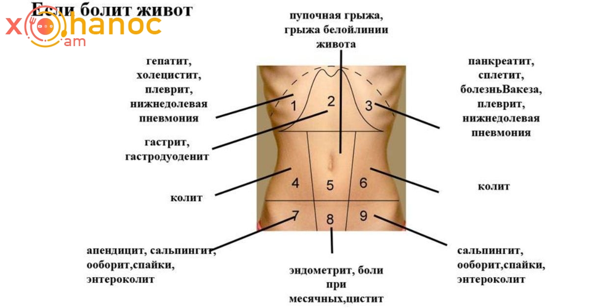 Որտեղ է ցավում. Որովայնի ցավի ուղեցույց