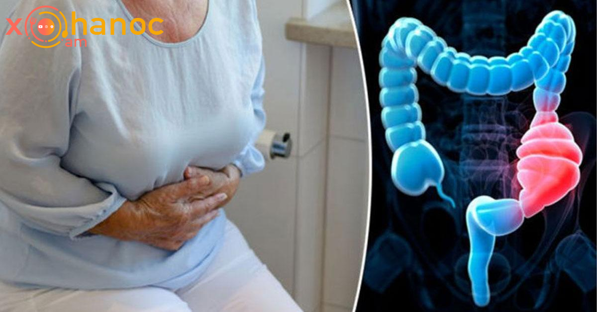 Նիհարելու և փորկապությունից ազատվելու համար օգտագործեք հետևյալ բաղադրատոմսը Նիհարելու և փորկապությունից ազատվելու համար օգտագործեք հետևյալ բաղադրատոմսը