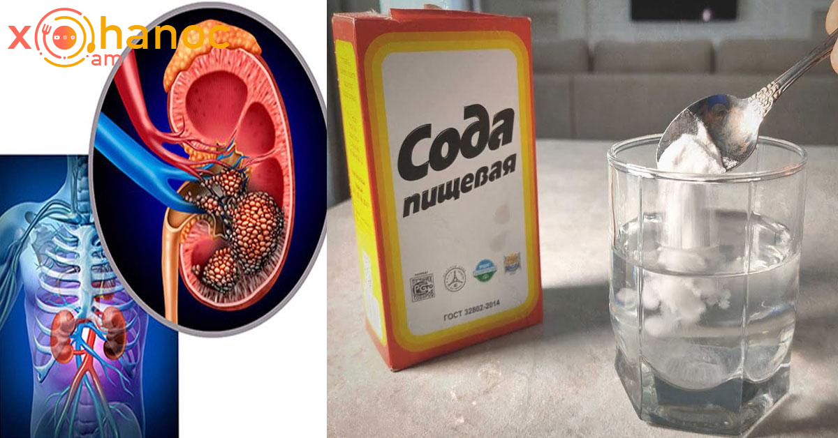 Տեսեք իրականում ինչ է տեղի ունենում ձեզ, երբ սոդայաջուր եք խմում․ Կարդացեք սա, նոր խմեք