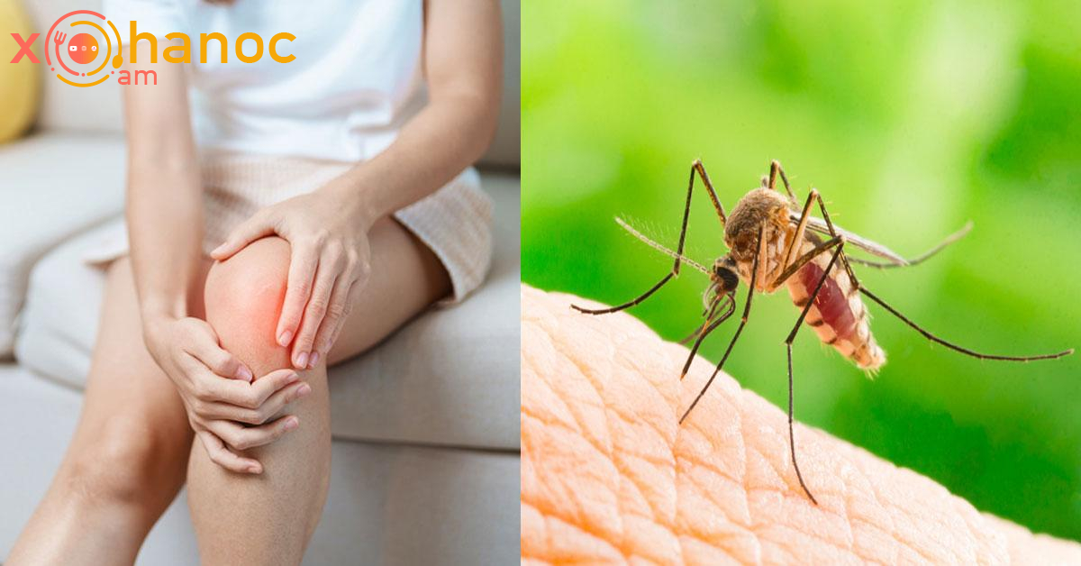 Որո՞նք են «Չիկունգունիա տենդ» հիվանդության ախտանիշները