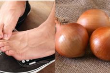 Վերացրեք ոտքերի տհաճ հոտը սոխի օգնությամբ