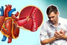 Ինչ է պետք անել և ինչպես օգնես ինքդ քեզ ինֆարկտի ժամանակ. Ունես ընդամենը 10 վակրկյան