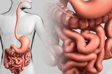 Այս մթերքը կերեք սառը վիճակում ՝ աղիքների աշխատանքը բարելավելու համար