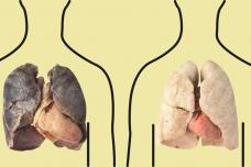 4 մթերքներ, որոնք իդեալական մաքրում են թոքերը. Ծխողներին խորհուրդ է տրվում անպայման կարդալ
