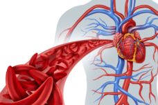 Մթերքներ, որոնք ջրիկացնում են արյունը․ Պահպանեք այս ցանկը