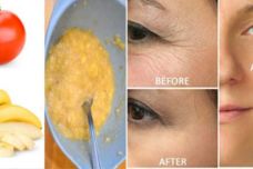Ազատվեք դեմքի կնճիռներից 3 օրում այս 3 բաղադրիչների միջոցով