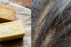 Սև օճառը կվերացնի թեփը․ Բայց հիշեք, այսպես է պետք օգտագործել