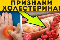 Մարմնի վրայի այս նշանը վկայում է, որ բարձր խոլեստերին ունեք