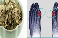 Այս աճած ոսկորը կոչվում է ոտնաթաթի բուրսիտ, իսկ այս բույսը կբուժի այն