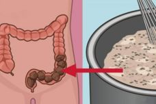 Նշան, որ ձեր աղիները լավ վիճակում չեն և մաքրման կարիք ունեն․ Կարդացեք նաև ինչպես մաքրել աղիները