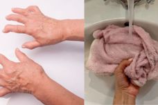 Այսպես կարող եք ազատվել արթրոզից