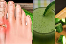 Բնական միջոցով հեռացրեք միզաթթուները հոդերից և խուսափեք հոդատապից և ուռուցքներից