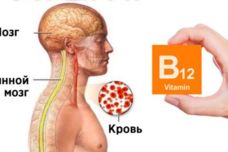 Եթե ձեզ մոտ առկա են այս նշանները, ուրեմն վիտամին B12-ի պակաս ունեք