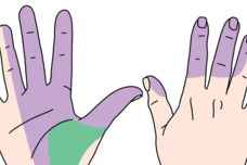 Ինչու՞ են վերջույթները թմրում․ Պատճառները և հավանական խնդիրը