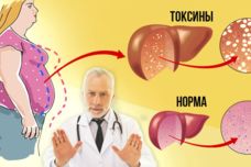 Բժշկի առաջարկած թուրմի պատրաստման եղանակը, որը մաքրում է լյարդը և այրում որովայնի ճարպը