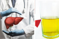 Այս բնական ըմպելիքը պատրաստեք, խմեք և ձեր լյարդը փոշեկուլի պես կմաքրվի