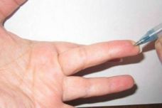 Հատուկ կետ մատի վրա, որը իջեցնում է ճնշումը․ Այն հաճախ են օգտագործում ռազմական բժշկության մեջ