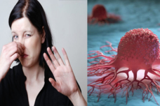 Եթե ​​ամենուրեք այս հոտն եք զգոջմ, դա քաղցկեղի նշան է, պարտադիր ստուգվեք