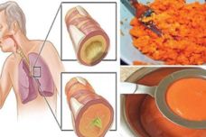 Մաքրեք ձեր թոքերը այս բաղադրատոմսով և ազատվեք հազից, գրիպից ու խորխից Մաքրեք ձեր թոքերը այս բաղադրատոմսով և ազատվեք հազից, գրիպից ու խորխից