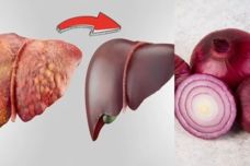 Պարզ միջոց, որը կվերականգնի ձեր լյարդը․ Պահպանեք, որպեսզի կիրառեք մոտ օրերս