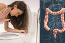 Սա հաստ աղիքի քաղցկեղի նշան է․ Շատերը ուշադրություն չեն դարձնում․ Երբ տեսնեք սա, շտապ դիմեք բժշկի