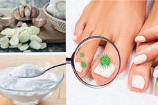 Այս բաղադրիչը կա բոլորի տանը․ Այն վերացնում է եղունգների սունկը և ազատում տհաճ հոտերից