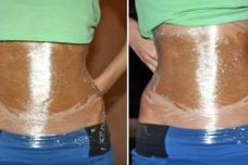 Այսպես արեք և փորի հատվածի ճարպը կվերանա ու կազատվեք կախված փորից