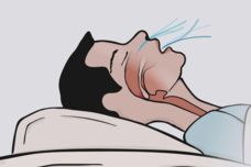 Գիշերային խռմփոցի վտանգները․ Ի՞նչ է դա նշանակում և ինչպե՞ս ազատվել խռմփոցից
