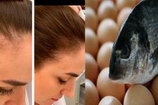 Ինչ ուտել, որպեսզի ձեր մազերը չթափվեն, վերականգնվեն և արագ աճեն. Մթերքների այս ցանկը պահպանեք ձեզ մոտ