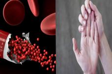 Սա օրգանիզմում երկաթի պակասի նշան է, աչքաթող մի արեք և շուտ դեմն առեք