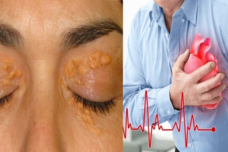 Սա կարող է լինել սրտի կաթվածի կամ ինսուլտի նշան