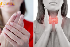 Ի՞նչ հիվանդության նշան է, երբ ձեռքերը անընդհատ սառն են